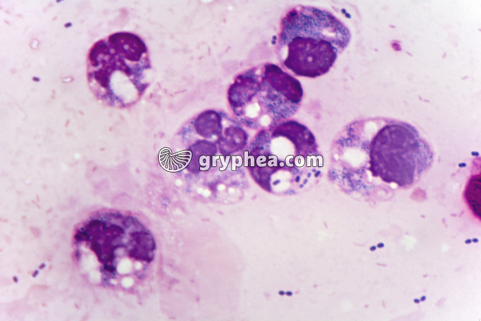 Pus avec Pneumocoques x400 - gryphea.org